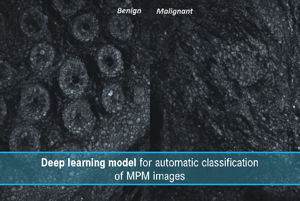 Project results short video series: Multiphoton Microscopy (MPM) Classifier